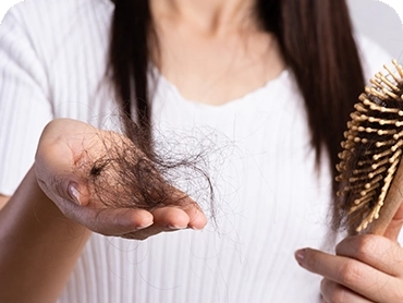 Tratamento de alopecia/queda capilar